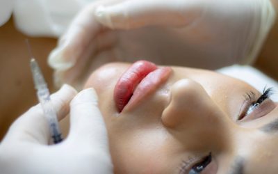 Injection d’acide hyaluronique en médecine esthétique : les dernières évolutions à connaitre en 2026